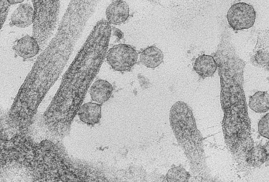 UA-Zero: SARS-Covid by Andreia Pinto