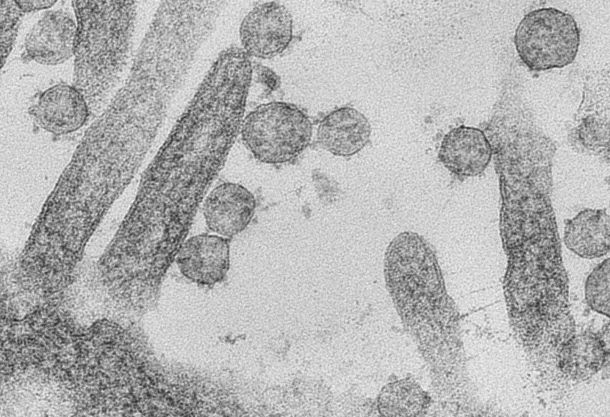 UA-Zero: SARS-Covid by Andreia Pinto