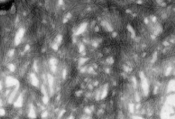 UA-Zero Application: Tobacco Mosaic Virus (TMV) negative staining