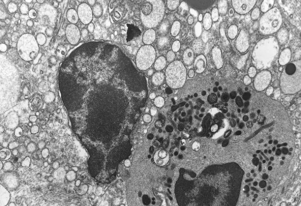 Using LR White for Electron Microscopy