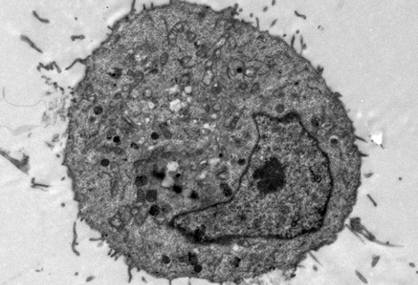 UA-Zero Application: Fixation, staining and processing of HeLa* cells grown on coverslips