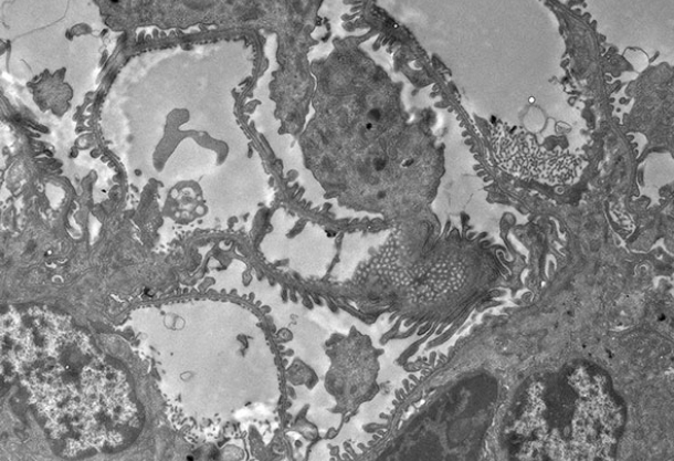 UA-Zero Application: Fixation, staining and processing of kidney tissue 