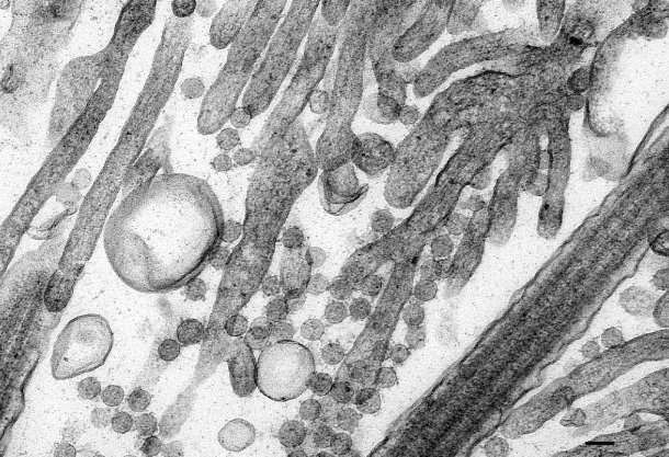 UA-Zero as a Uranyl Acetate Replacement When Diagnosing Primary Ciliary Dyskinesia by Transmission Electron Microscopy