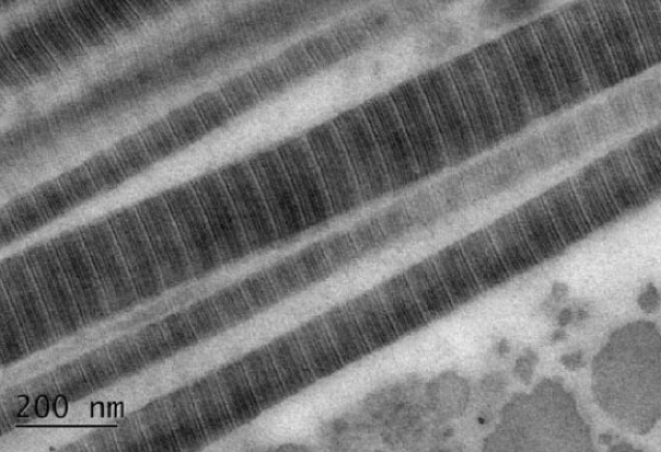 Uranyl Acetate vs. UA-Zero: Human Scera Collagen Fibrils